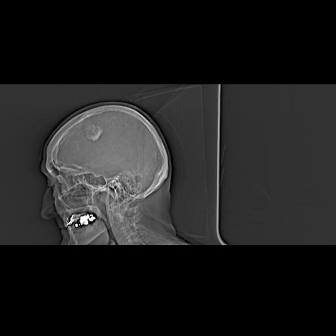 Series: 20050502230812