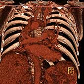 Case of the Day www.cox.at